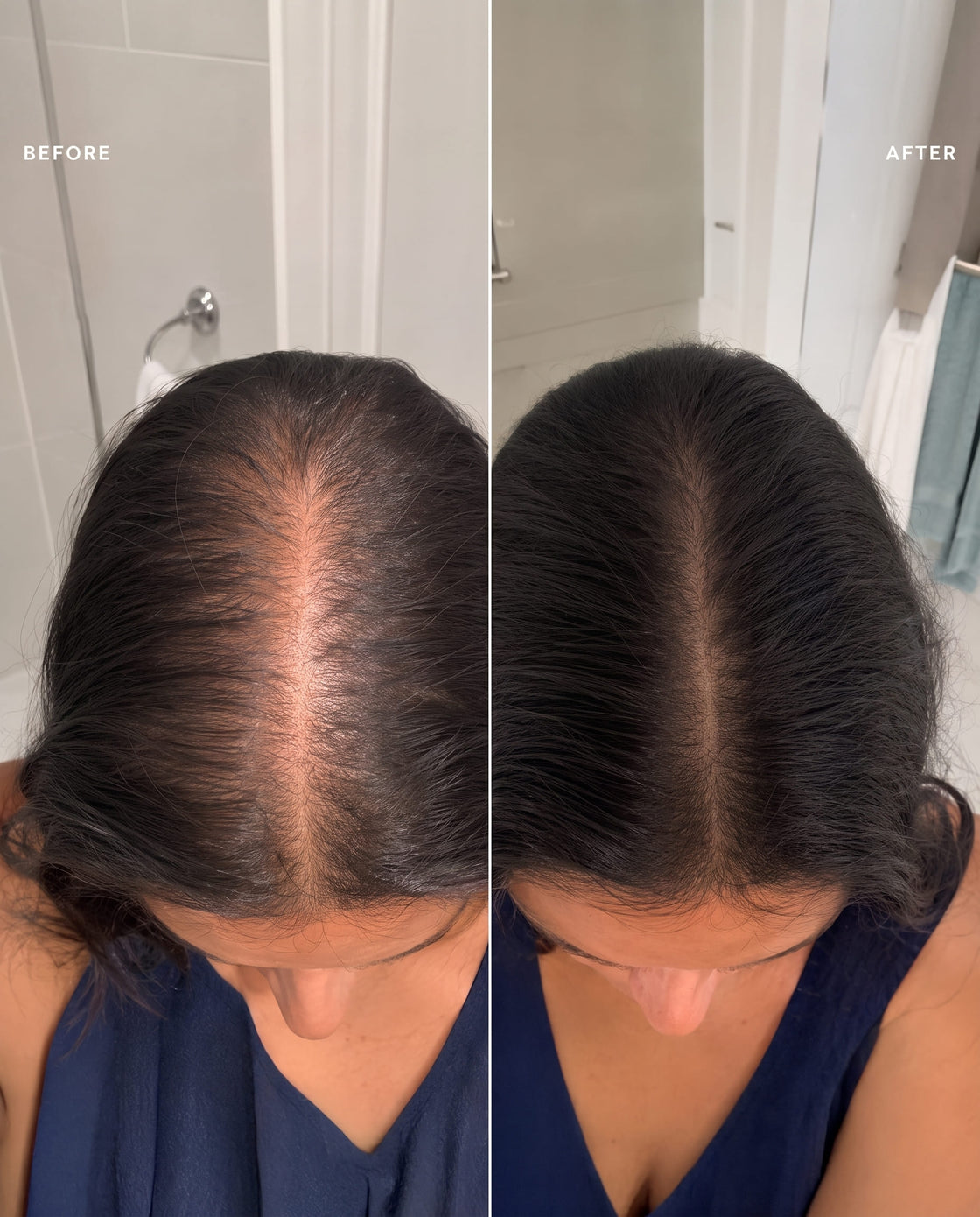 before and after