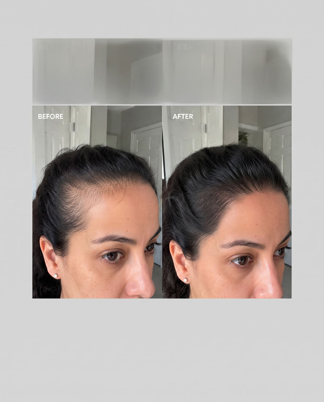 before and after
