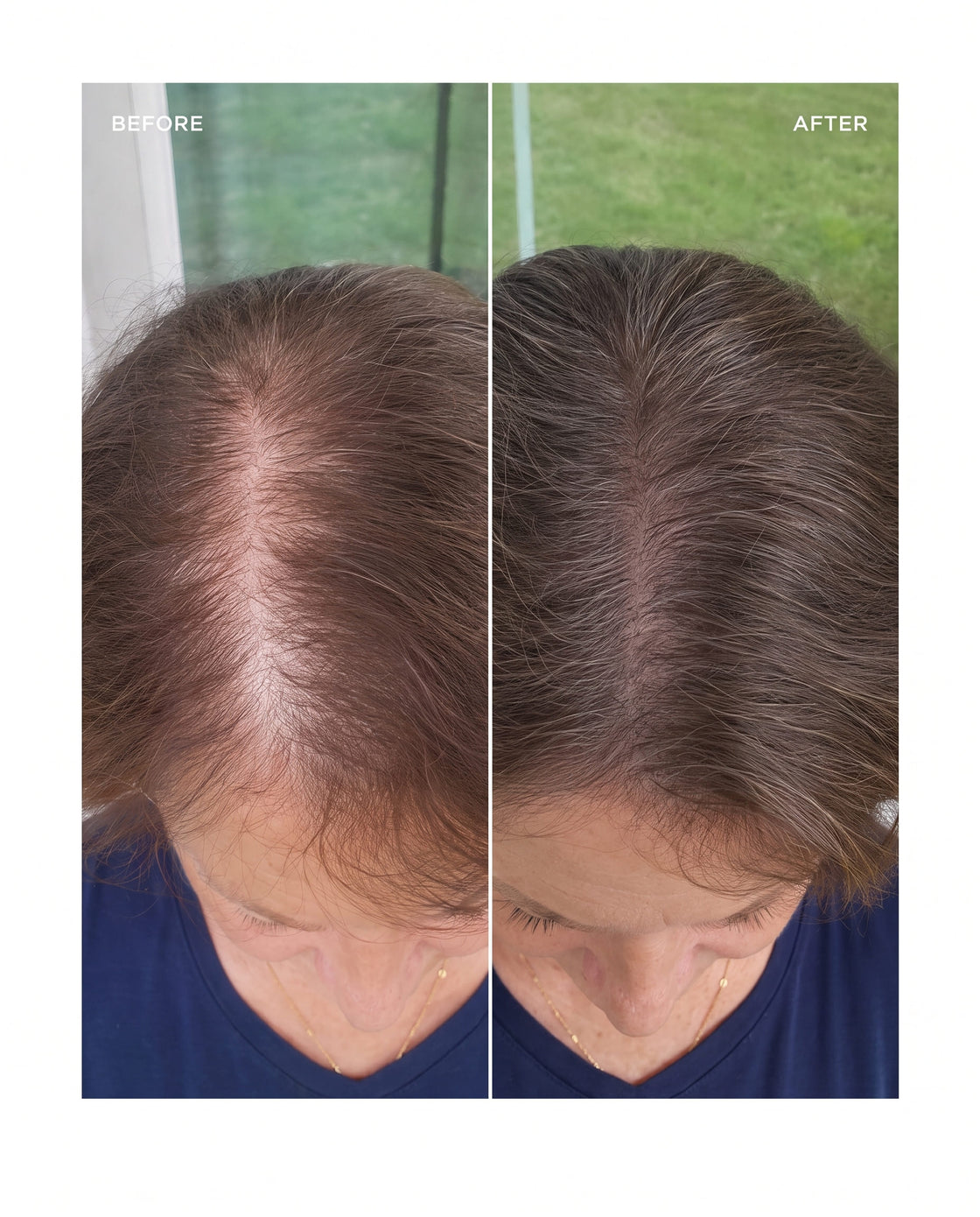 before and after